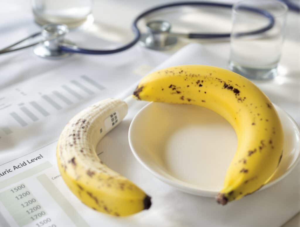 banane et acide urique